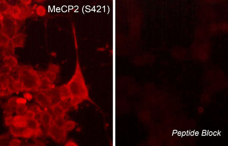 Immunocytochemical labeling of MeCP2 phosphorylation in rat PC12 cells differentiated with NGF. The cells were probed with MeCP2 (Ser-421) rabbit polyclonal antibody (MP4611) in the absence (left) or presence (right) of blocking peptide (MX4615). The antibody was detected using appropriate secondary antibody conjugated to DyLight® 594.