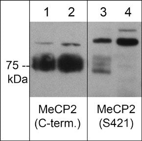 Western blot of human PC3 cells treated with calyculin A (25 mM) for 15 min. The blot lanes were untreated (lanes 1 & 3) or treated with lambda phosphatase (lanes 2 & 4) then probed with rabbit polyclonals anti-MeCP2 (C-terminus) (lanes 1 & 2) or anti-MeCP2 (Ser-421) (lanes 3 & 4).