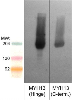 Western blot analysis of MYH13 in mouse extraocular muscle. The blot was probed on the left with anti-MYH13/Extraocular myosin (Hinge region) antibody (MP4571) and on the right with anti-MYH13/Extraocular myosin (C-terminal region) antibody (MP4561).