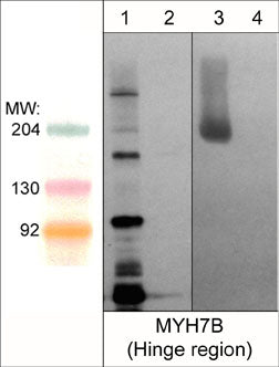 Western blot analysis MYH7B in mouse brain (lane 1 & 2) and mouse extraocular muscle (lane 3 & 4). The blot was probed with rabbit polyclonal anti-MYH7B/MHC14 (Hinge region) at 1:500 in absence (lanes 1 & 3) and presence of MYH7B blocking peptide (MX4555; lanes 2 & 4).