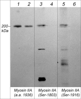 Western blot image of human A431 cells stimulated with calyculin A (100 nM, 30 min). The blots were untreated (lanes 1, 3 & 5) or treated with lambda phosphatase (lanes 2, 4 & 6), and probed with rabbit polyclonals Myosin IIA Heavy Chain (a.a. 1936-1950) (lanes 1 & 2), Myosin IIA Heavy Chain (Ser-1803), phospho-specific (lanes 3 & 4) or Myosin IIA Heavy Chain (Ser-1916) phospho-specific (lanes 5 & 6).