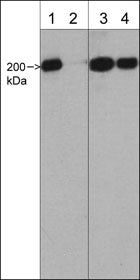 Western blot image of human A431 cells. The blots were untreated (lanes 1 & 3) or treated with lambda phosphatase (lanes 2 & 4), then probed with rabbit polyclonal Myosin IIA Heavy Chain (Ser-1943), phospho-specific antibody (lanes 1 & 2) or rabbit polyclonal Myosin IIA Heavy Chain (a.a. 1936-1950)  antibody (lanes 3 & 4).