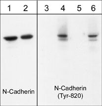 Western blot image of human endothelial cells untreated (lanes 1 & 3) or treated with pervanadate (1 mM) for 30 min (lanes 2, 4, 5 & 6). The blots were probed with anti-N-Cadherin (Cytoplasmic) (lanes 1 & 2) and anti-N-cadherin (Tyr-820) (lanes 3-6). The latter antibody was used in the presence of no peptide (lane 4), phospho-N-cadherin (Tyr-820) peptide (lane 5), or phospho-N-cadherin (Tyr-860) peptide (lane 6).