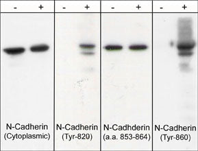 Western blot image of human endothelial cells untreated or treated with pervanadate (1 mM) for 30 min. Blots were probed with anti-N-Cadherin (Cytoplasmic), anti-N-Cadherin (Tyr-820), anti-N-Cadherin (a.a. 853-864), and anti-N-Cadherin (Tyr-860).