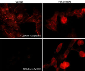 Immunocytochemical labeling of phosphorylated N-Cadherin in pervanadate-treated mouse C2C12. The cells were labeled with mouse monoclonal N-Cadherin (Cytoplasmic) and rabbit polyclonal N-Cadherin(Tyr-860) antibodies, then the antibodies were detected using appropriate secondary antibodies conjugated to Cy3.