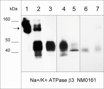 Western blot of NM0161 immunoprecipitates (IP) and whole lysates. The NM0161 antibody only (lane 1), IP from A431 cell lysate (lane 2), A431 cell input (lane 3), LNCaP cells (lane 4), MeWo cells (lane 5), and normal human lung (lane 6) and skin (lane 7). The blot was probed with anti-Na+/K+ ATPase β3 NM0161 (lanes 1-7). The arrow designates native antibody, while the β3 subunit migrates around 40 kDa.