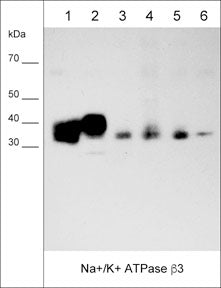 Western blot of native human MDA-MB-231 (lane 1), and MeWo (lane 2) cell lysates, as well as native human breast (lane 3), lung (lane 4), skin (lane 5), and brain (lane 6) tissues. The blot was probed with anti-Na+/K+ ATPase β3 (NM0251) at 1:1000.
