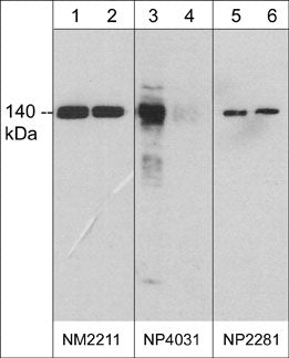 Western blot analysis of human umbilical vein endothelial cells stimulated with pervanadate (1 mM) for 30 min. (lanes 1, 3, & 5) then the blot was treated with alkaline phosphatase (lanes 2, 4, & 6). The blots were probed with anti-eNOS monoclonal antibody (NM2211; lanes 1 & 2), anti-eNOS (Tyr-657) phospho-specific antibody (NP4031; lanes 3 & 4), or anti-eNOS polyclonal antibody (NP2281; lanes 5 & 6).