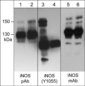 Western blot analysis of mouse macrophages (J774A.1) treated with LPS (1µg/ml) for 18 hrs followed by pervanadate (1 mM) for 30 min. (lanes 1, 3 & 5). The blots were then treated with akaline phosphatase (lanes 2, 4 & 6). Blots were probed with rabbit polyclonal anti-inducible Nitric Oxide Synthase (iNOS) (lanes 1 & 2), anti-iNOS (Tyr-1055) (lanes 3 & 4), and mouse monoclonal anti-iNOS (lanes 5 & 6).