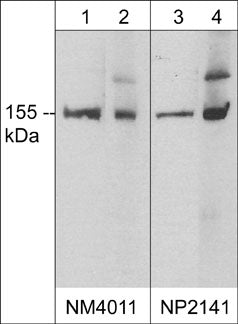 Western blot analysis of nNOS expression in adult mouse brain (lanes 1 & 3) and rat GC cells (lanes 2 & 4). The blots were probed with mouse monoclonal anti-nNOS (C-terminal region) at 1:1000 (lanes 1 & 2) or rabbit polyclonal anti-nNOS at 1:250 (lanes 3 & 4).