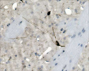 Formalin fixed, citric acid treated parafin sections of adult Rat striatum. Sections were probed with anti-nNOS (NP2141) then anti-Rabbit:HRP before detection using DAB. (Images provided by Carl Hobbs and Dr. Pat Doherty at Wolfson Centre for Age-Related Diseases, King's College London).