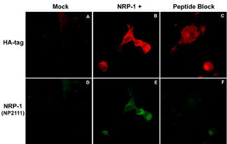 Immunocytochemical double labeling using anti-HA mouse monoclonal and anti-NRP-1 rabbit polyclonal (NP2111) antibodies in COS-7 cells mock transfected (A,D) or transfected with NRP-1 constructs (B,E). The specificity of the binding in E was demonstrated by using NRP-1 peptide (NX2115) in the presence of the anti-NRP-1 antibody (C,F).
