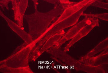 Immunocytochemical labeling of Na+/K+ ATPase β3 in paraformaldehyde fixed human MeWo melanoma cells. The cells were labeled with mouse monoclonal anti-Na+/K+ ATPase β3 (clone M025). The antibody was detected using goat anti-mouse Ig DyLight® 594.