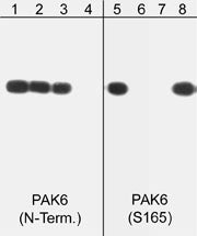 Western blots of human PAK6 recombinant protein phosphorylated by ERK2. The blot was exposed to lambda phosphatase (lanes 2 & 6) then probed with anti-PAK6 (N-terminal) (lanes 1-4) or anti-PAK6 (Ser-165) phospho-specific (lanes 5-8). The antibodies were used in the presence of unrelated (lane 3) and PAK6 (N-terminal) (lane 4) peptide or PAK6 (Ser-165) (lane 7) and unrelated phospho-serine (lane 8) peptides, respectively.