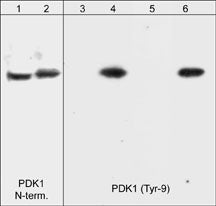 Western blot image of A431 cells untreated (lanes 1 and 3) or treated with pervanadate (lanes 2, 4, 5 & 6). Blots were probed with anti-PDK1 (PP1411) or anti-PDK1 (Tyr-9) (PP1431). The latter was used in the presence of no peptide (lane 4), phospho-PDK1 (Tyr-9) peptide (lane 5), or an unrelated phosphotyrosine peptide (lane 6).