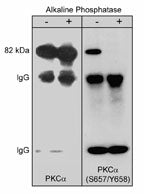 Western blot analysis of immunoprecipitates from neonatal rat brain lysate using anti-PKCα antibody. Control and alkaline phosphatase treated precipitates were probed with anti-PKCα (Central region) or anti-phospho-PKCα (Ser-657/Tyr-658). The latter shows no detection of PKCα after phosphatase treatment.