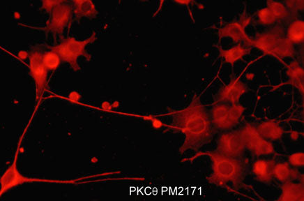Immunocytochemical labeling of PKCθ in rat PC12 cells differentiated with NGF. The cells were labeled with mouse monoclonal PKCθ (N-terminal region) antibody, then detected using appropriate secondary antibody conjugated to Cy3.