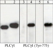Western blot analysis of PLCγ1 immunoprecipitates from human jurkat cells untreated (lanes 1 & 3) or treated with pervanadate (1 mM) for 30 min (lanes 2,4,5,6). Immunoprecipitation was performed with anti-PLCγ1 (PM1561). The blots were probed with anti-PLCγ1 (lanes 1 & 2) and anti-PLCγ1 (Tyr-775) (lanes 3-6). The latter antibody was used in the presence of phospho- PLCγ1 (Tyr-775) peptide (lane 5), or unrelated phosphotyrosine peptide (lane 6).