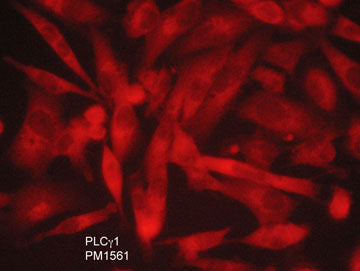 Immunocytochemical labeling of PLCγ1 in adelhyde-fixed and NP-40 permeabilized human MDA-MB-231 breast carcinoma cells. The cells were labeled with mouse monoclonal anti-PLCγ1 (PM1561) antibody. The antibody was detected using appropriate secondary antibody conjugated to DyLight® 594.