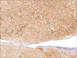 Formalin fixed, citric acid treated parafin sections of adult mouse brain. Sections were probed with anti-PKCα (PM2371) then anti-mouse:HRP before detection using DAB. (Image provided by Carl Hobbs and Dr. Pat Doherty at Wolfson Centre for Age-Related Diseases, King's College London).