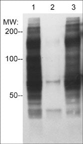 Western blot of HeLa cells treated with pervanadate (1 mM) for 30 min. Phosphotyrosine containing proteins were immunoprecipitated with rabbit polyclonal anti-Phosphotyrosine:Agarose (Lane 1) or with no antibody agarose beads (Lane 2), and blots were made that included the whole lysate (Lane 3). The blots were probed with mouse monoclonal anti-Phosphotyrosine (PM3751) to detect phosphotyrosine containing proteins.