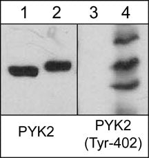 Western blot analysis of human Jurkat cells untreated (lanes 1 & 3) or treated with pervanadate (1 mM) for 30 min. (lanes 2 & 4). The blot was probed with anti-PYK2 (C-terminal region) antibody (lanes 1 & 2) or anti-PYK2 (Tyr-402) (lanes 3 & 4).