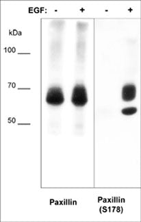 Western blot analysis of A431 cells (20 µg/lane) serum starved overnight and treated with EGF (100 ng/ml) for 5 min. The blot was probed with anti-Paxillin mouse monoclonal (PM1071) or anti-Paxillin (Ser-178) rabbit polyclonal (PP1051).