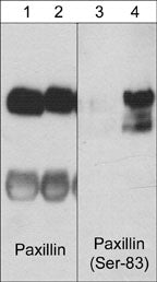 Western blot analysis of PC12 cells untreated (lanes 1 & 3) or treated with NGF (200 ng/ml) for 60 min (lanes 2 & 4). The blots were probed with mouse monoclonal anti-Paxillin (PM1071; lane 1 & 2) or rabbit polyclonal anti-Paxillin (Ser-83) phospho-specific antibody (lane 3 & 4).