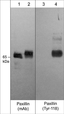 Western blot analysis of A431 cells (30 µg/lane) serum starved overnight (lane 1 & 3) or treated with pervanadate (1 mM) for 30 min (lanes 2 & 4). The blot was probed with mouse monoclonal anti-Paxillin (PM1071) (lanes 1 & 2) and rabbit polyclonal anti-phospho-Paxillin (Tyr-118) (PP4501) (lanes 3 & 4).