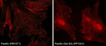 Immunocytochemical labeling of Ser-83 phosphorylated paxillin in rabbit spleen fibroblasts. The cells were labeled with mouse monoclonal Paxillin (left) and rabbit polyclonal Paxillin (Ser-83, right) antibodies, then detected using appropriate secondary antibodies conjugated to Cy3.