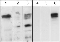 Western blots showing mouse brain (lanes 1 & 4), and Cos-7 cells untransfected (lanes 2 & 5) or transfected with mouse myc-tagged Plexin-A1 (lanes 3 & 6). The blots were probed with either affinity purified anti-Plexin-A1 (PP1471); lanes 1-3) or with mouse monoclonal anti-Myc (lanes 4-6).