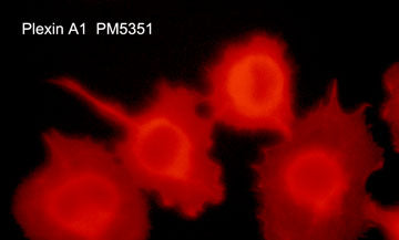 Immunocytochemical labeling of Plexin A1 in aldehyde fixed and NP-40 permeabilized human NCI-H1299 lung carcinoma cells. The cells were labeled with mouse monoclonal anti-Plexin A1 (PM5351). The antibody was detected using goat anti-mouse DyLight® 594.