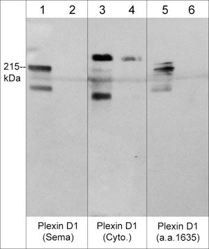 Western blot analysis of Plexin D1 expression in human endothelial cells (HUVEC) (lanes 1-6). The blots were probed with rabbit polyclonals anti-Plexin D1 (Sema domain) (lanes 1 & 2), anti-Plexin D1 (Cytoplasmic domain) (lanes 3 & 4), and anti-Plexin D1 (a.a. 1635-1647) (lanes 5 & 6). Each antibody was used in the presence of their respective blocking peptide (lanes 2, 4 & 6).