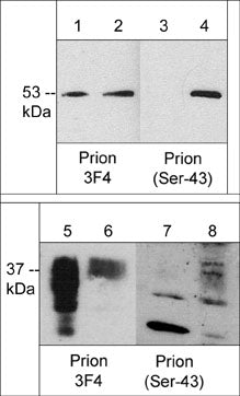 Western blot of GST recombinant human full-length prion protein that was untreated (lanes 1 and 3) or phosphorylated with Cdk5/p25 (lanes 2 & 4). Endogenous prion phosphorylation was examined in human PC3 cells untreated (lanes 5 & 7) or treated with Calyculin A (100 nM) for 30 min (lanes 6 & 8). The blots were probed with anti-Prion protein (3F4) (lanes 1, 2, 5, & 6) or anti-Prion protein (Ser-43) (lanes 3, 4, 7, & 8).
