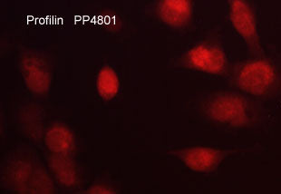Immunocytochemical labeling of Profilin in aldehyde-fixed and NP-40 permeabilized human NCI-H1915 lung carcinoma cells. The cells were labeled with rabbit polyclonal anti-Profilin (PP4801) antibody. The antibody was detected using appropriate secondary antibody conjugated to DyLight® 594.