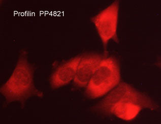 Immunocytochemical labeling of Profilin in aldehyde-fixed and NP-40 permeabilized human NCI-H1915 lung carcinoma cells. The cells were labeled with rabbit polyclonal anti-Profilin (PP4821) antibody. The antibody was detected using appropriate secondary antibody conjugated to DyLight® 594.