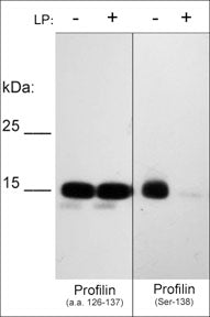 Western blot of human recombinant Profilin-1 phosphorylated in vitro with PKCα kinase then untreated (-) or treated with lambda
phosphatase (+). The blots were probed with anti-Profilin (a.a. 126-137) (left panel) or anti-Profilin (Ser-138) phospho-specific (right panel) antibodies at 1:1000.