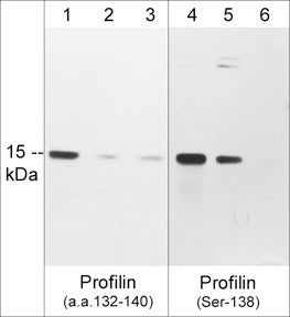 Western blot of Jurkat stimulated with calyculin A (100 nM) for 30 min (lanes 1-6). The blots were probed with anti-Profilin (a.a. 132-140) (lanes 1-3) or anti-Profilin (Ser-138) phospho-specific (lanes 4-6). Both antibodies were used in the absence (lanes 1 & 4) or presence of unphosphorylated Profilin (Ser-138; PX4825) (lanes 2 & 5) or phospho-Profilin (Ser-138; PX4795) (lanes 3 & 6) blocking peptides.