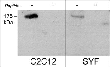 Western blot analysis of C2C12 and SYF mouse cell lines. The blots were probed with anti-Robo2 (C-terminal region) in the absence (-) or presence (+) of Robo2 (C-terminal region) blocking peptide (RX2865).