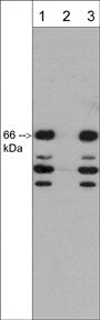 Western blot analysis of adult mouse brain.  The blot was probed with rabbit polyclonal anti-SCAI (N-terminal region) antibody in the presence (lanes 2) or absence (lane 1) of SCAI (N-terminal region) blocking peptide (SX3845), or unrelated peptide (lane 3).