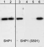 Western blot analysis of human Jurkat cells treated with pervanadate (1 mM) for 30 min. The blot was exposed to lambda phosphatase (lanes 2 & 4) then probed with anti- SHP1 (C-terminal) antibody (lanes 1 & 2) or anti-SHP1 (Ser-591) antibody (lanes 3-6). The SHP1 (Ser-591) antibody was used in the presence of phospho-SHP1 (Ser-591) peptide (lane 5) or a non-specific phospho- serine peptide (lane 6).