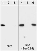 Western blot image of recombinant his-tagged human SK1 protein that was phosphorylated with ERK-2. Blots were probed with anti-SK1 (Central Region) (SP1621; lanes 1-3) and anti-SK1 (Ser-225) (SP1641; lanes 4-6). Both antibodies were used in the presence of no peptide (lanes 1 & 4), phospho-SK1 (Ser-225) peptide (SX1645; lanes 2 & 5), or unphosphorylated SK1 (Ser-225) peptide (SX1625; lanes 3 & 6).