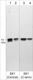 Western blot image of recombinant his-tagged human SK1 protein. Blots were probed with rabbit polyclonals anti-SK1 (Central Region) (SP1621) at 1:1000 (lane 1) and 1:4000 (lane 2), and anti-SK1 (C-terminal region) (SP5421) at 1:1000 (lane 3) and 1:4000 (lane 4).