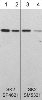 Western blot of human recombinant SK2 (lanes 1-4). The blots were probed with rabbit polyclonal anti-SK2 (N-terminal region) at 1:250 (lane 1) and 1:1000 (lane 2) or with mouse monoclonal anti-SK2 (N-terminal region) at 1:250 (lane 3) or 1:1000 (lane 4).