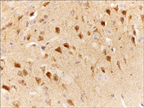 Formalin fixed, citric acid treated parafin sections of mouse cerebral cortex. Sections were probed with anti-Slingshot-1L (SP1711) then anti-Rabbit:HRP before detection using DAB. (Image provided by Carl Hobbs and Dr. Pat Doherty at Wolfson Centre for Age-Related Diseases, King's College London).