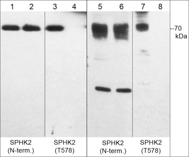 Western blot of human recombinant SK2 (lanes 1-4) and HeLa treated with calyculin A (lanes 5-8). The blots were untreated (lane 1, 3, 5 & 7) or treated with lambda phosphatase (lane 2, 4, 6 & 8), then probed with anti-SK2 (N-terminal region) (lanes 1, 2, 5 & 6) or anti-SK2 (Thr-578) (lanes 3, 4, 7, & 8).