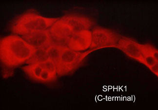 Immunocytochemical labeling of sphingosine kinase 1 (SPHK1) in paraformaldehyde fixed and NP-40 permeabilized A431 cells. The cells were labeled with rat monoclonal anti-SPHK1 (SM5401). The antibody was detected using goat anti-rat DyLight® 594.
