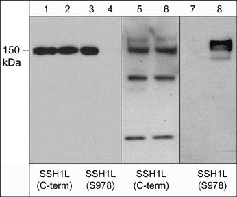 Western blot of human recombinant SSH1L untreated (lanes 1 & 3) or treated with lambda phosphatase (lanes 2 & 4) and rat PC12 cells unstimulated (lanes 5 & 7) or stimulated with calyculin A (lanes 6 & 8). The blots were probed with anti-SSH1L (C-term.) (lanes 1, 2, 5, & 6) or anti-SSH1L (Ser-978) (lanes 3, 4, 7, & 8).