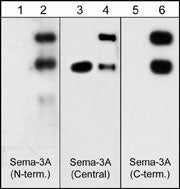 Western blots of neonatal rat brain (lanes 1, 3 & 5) and human recombinant Sema3A/Fc chimera (95/125 kDa) (lanes 2, 4 & 6). Blots were probed with anti-Sema3A (SP1401) (lanes 1 & 2), anti-Sema3A (SP1221) (lanes 3 & 4) and anti-Sema3A (SP1241) (lane 5 & 6). The antibodies recognize both the 95 kDa and 125 kDa forms of the recombinant Sema3A.