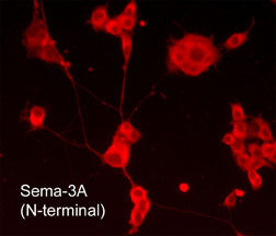 Immunocytochemical labeling of Sema-3A in aldehyde-fixed and NP-40-permeabilized NGF-differentiated PC12 cells. The cells were labeled with rabbit polyclonal Sema-3A (N-terminal) antibody (SP1401), then the antibody was detected using appropriate secondary antibody conjugated to DyLight® 594.